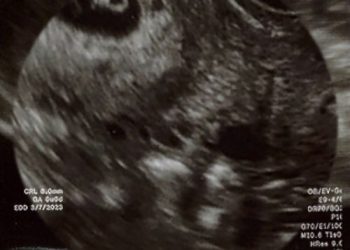 [Single] TOOBOE – 往生際の意味を知れ！ / TOOBOE – Ōjōgiwa no imi o shire! (2023.03.07/MP3/RAR)